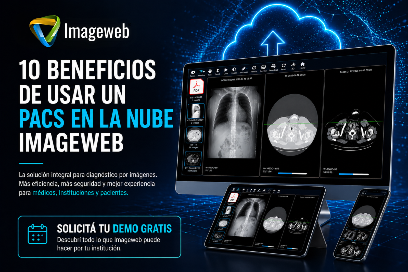 PACS en la nube para radiología digital y diagnóstico por imágenes